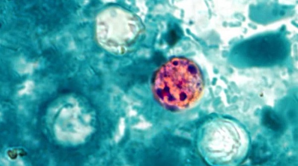 Protect yourself and your family from cyclosporiasis